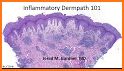 Barnhill's Dermatopathology Challenge related image