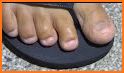 Foot Slap related image