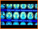 Cognity - Alzheimer’s and Dementia Test related image