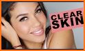 How To Get Clear Skin Fast related image