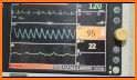 EKG Electrocardiography Exam review  Free App related image