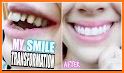Smile Dental related image