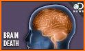 Brain Out – Can you pass it? related image
