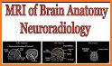 CT Passport Head/Brain / sectional anatomy / MRI related image
