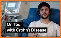 Crohn's Disease related image