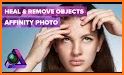 Pimple Remover Photo Editor (Bêta) related image