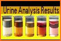 BK Urine Analysis related image