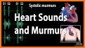 Heart murmur related image