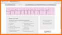 ACLS Test Prep related image