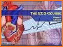 ECG Challenge related image