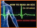 Medicos ECG :Clinical Guide & Daily EKG/ ECG Cases related image