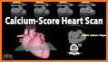 HeartScan: Monitor Your Heart related image