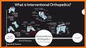 Interventional Orthopedics related image