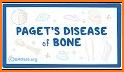 All bones diseases and treatments related image