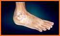 How To Treat A Sprained Ankle related image