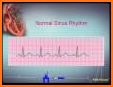 ECG Reader free related image