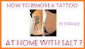 How to Remove a Tattoo related image