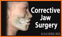 Jaw and Teeth related image