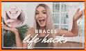 Cleaning Tips with Braces related image