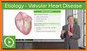 Valvular Heart Disease related image