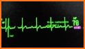 Block Monitor related image