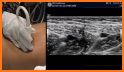 Vascular Ultrasound related image