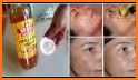 Remedios para las manchas de la cara related image
