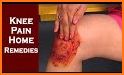 Knee Pain Home Remedies related image