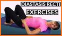 Diastasis Recti Exercises related image