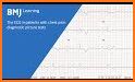ECG Check related image
