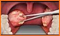 Throat Surgery Simulator related image
