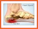 How to Get Rid from Heel Pain related image
