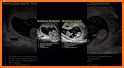 Momitalk: Pregnancy Ultrasound related image