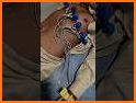 InVivo: ECG Course related image