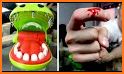 Crocodile Dentist related image