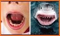 Shark Baby Dentist related image
