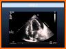Ultrasound cases + related image