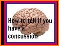 Concussion Quick Check related image