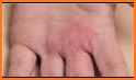 Diagnose skin problems related image