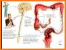 Constipation Management related image