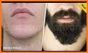 Como hacer crecer la barba related image
