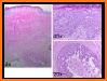 Pathology Review Quiz related image