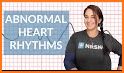 Heart Rhythm related image