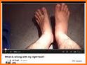 SWOLLEN FEET HOME REMEDIES related image