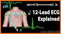 ECG in Motion – The innovative ECG education-tool related image