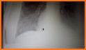 Easy Chest X-Ray related image