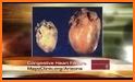 Heart Failure Info related image