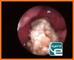 Endoscopy in Dogs related image