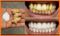 Whiten teeth naturally related image