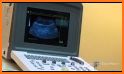 Abdominal Ultrasound pc related image